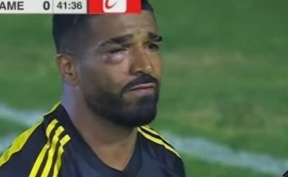 Rodrigo Aguirre recibe fuerte golpe en el ojo y tuvo que salir del partido de América