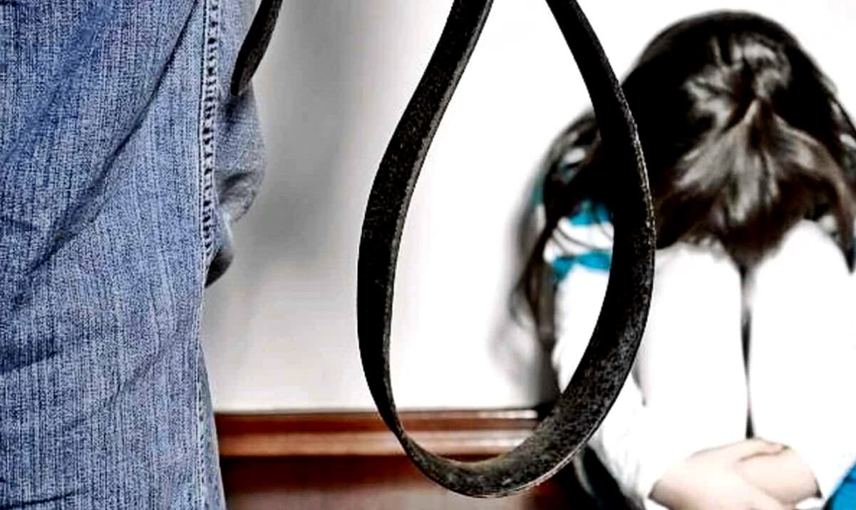 Automovilista atropella a un hombre y pierde la vida 