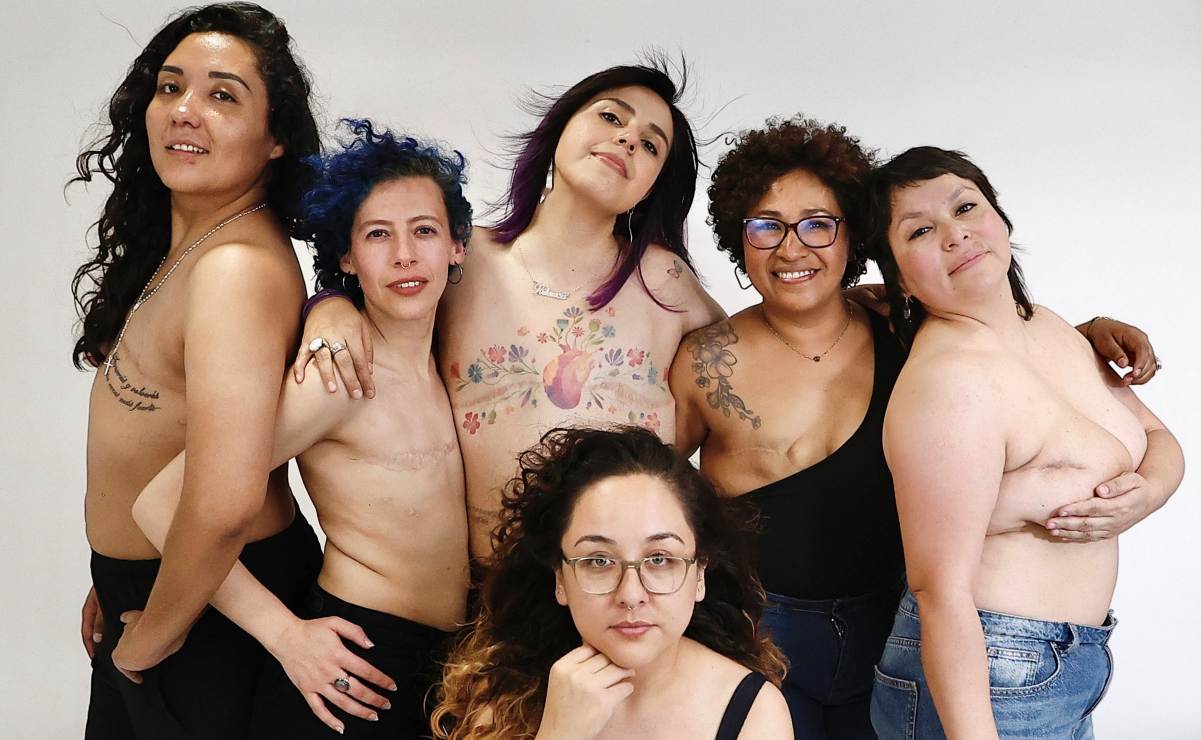 “La mastografía es una forma de quererme a mí misma”