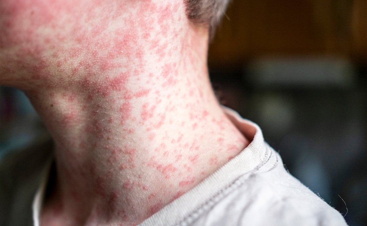 Morrissey cancela conciertos en México, otra vez, y los memes no perdonan