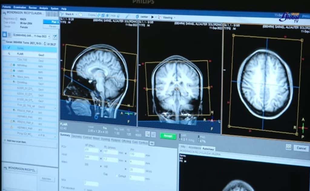 En-la-UNAM-analizan-cerebros-de-personas-gemelas-buscan-respuestas-a-enfermedades
