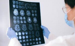 El tamaño de tu cerebro puede revelar enfermedades: Universidad de Pensilvania