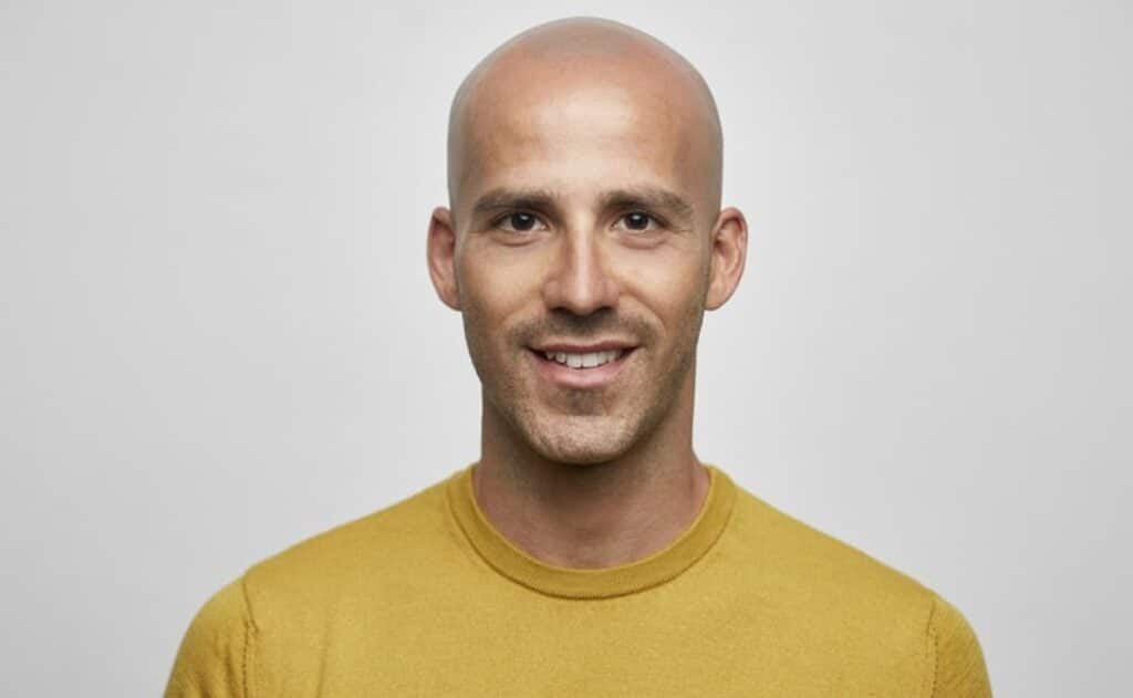 3 mitos persistentes sobre la calvicie, según una experta de la Universidad de California