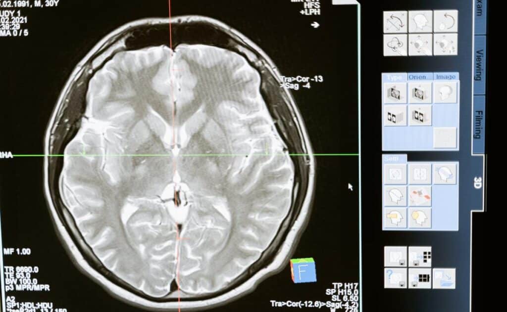 Escuchar música o tocar un instrumento musical modifican el cerebro