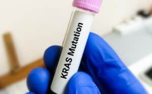 KRAS, la proteína “maldita” del cáncer que es el objetivo de investigaciones para tratamientos modernos