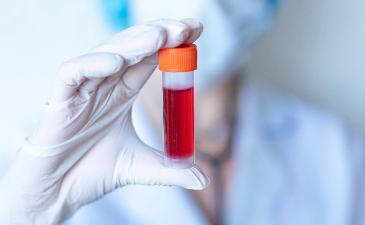 necesitas-estudios-clinicos-fes-cuautitlan-ofrece-opciones-a-bajo-costo