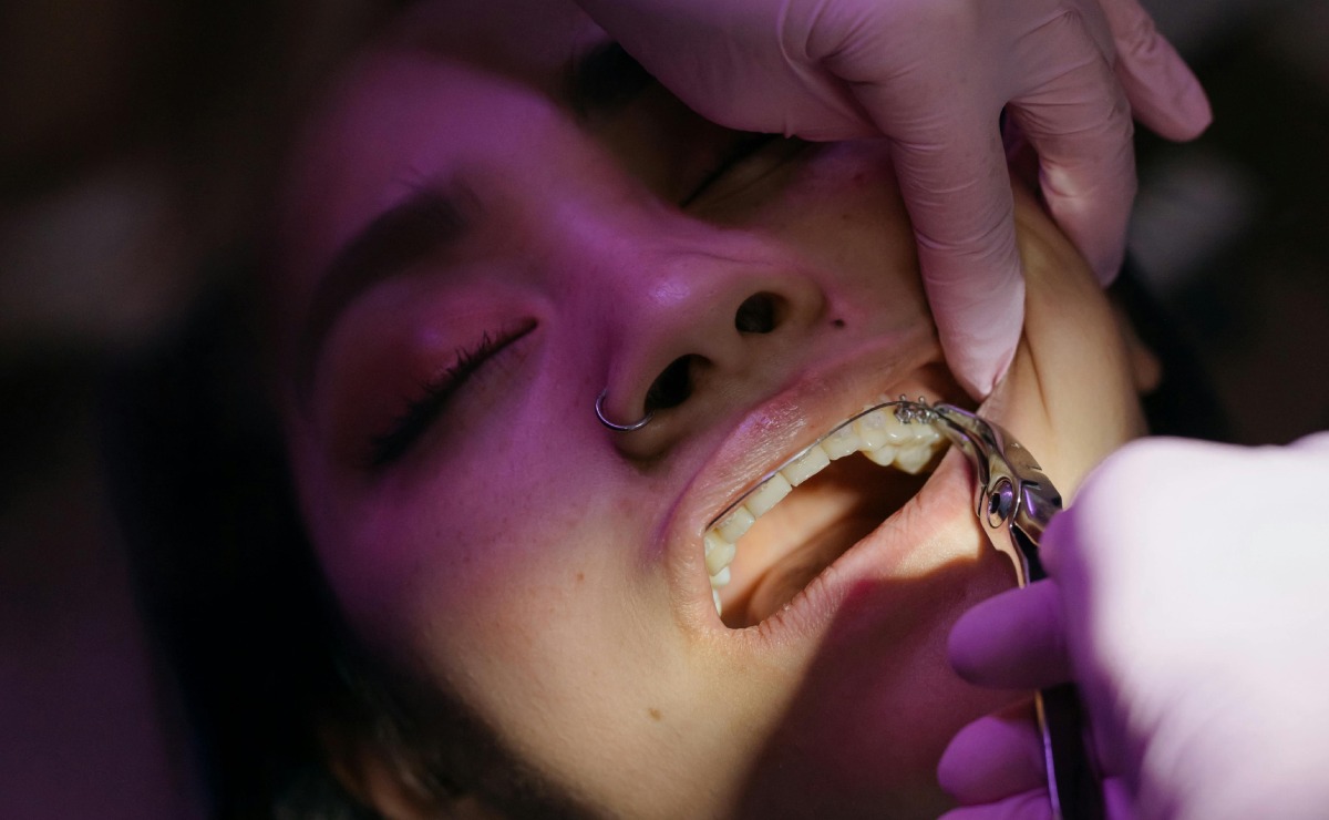 te-urge-ir-al-dentista-visita-la-clinica-periferica-oriente-de-la-unam